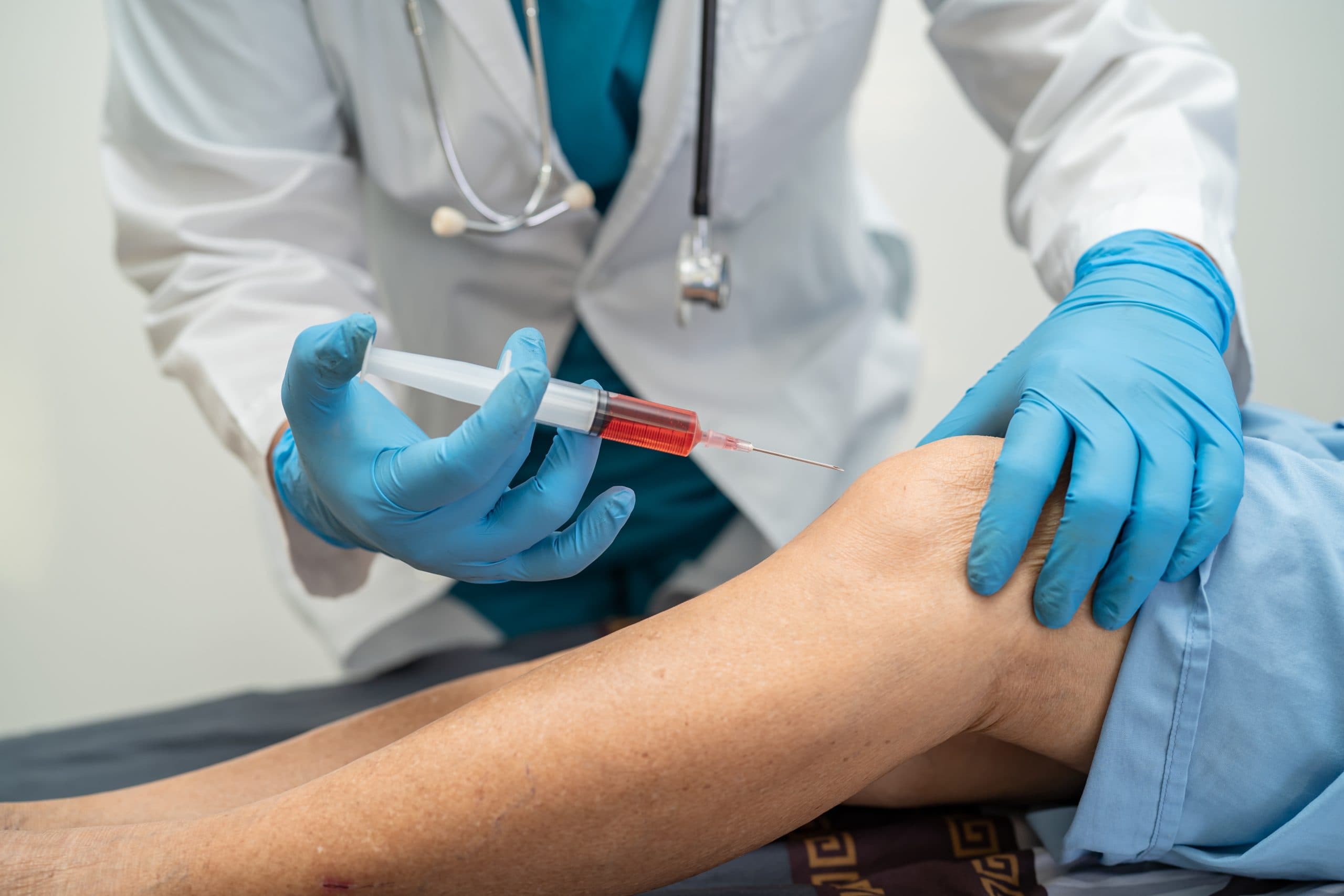 Regenerative cartilage cells prepared at London Cartilage Clinic