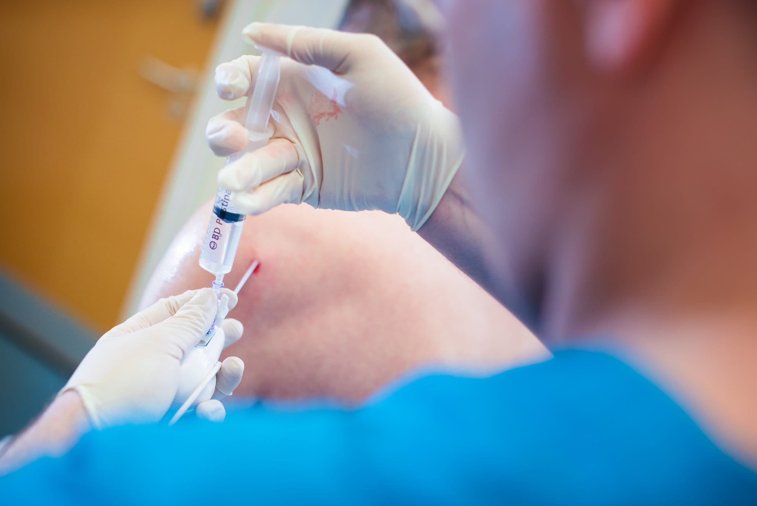 Regenerative micrografts prepared from your own cells at London Cartilage Clinic